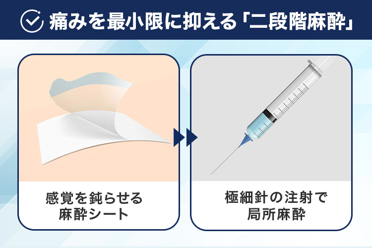痛みを最小限に抑える「二段階麻酔」