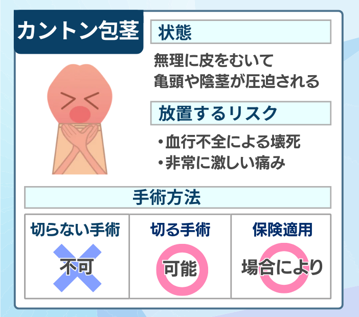 カントン包茎